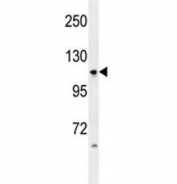 Anti-LGR5 antibody western blot analysis in HL-60 lysate