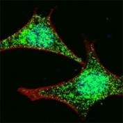 Fluorescent confocal image of HeLa cells stained with LGR-5 antibody at 1:100. Note the highly specific localization of the LGR5 immunosignal to the nucleus and cytoplasm.