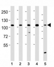 Western blot testing of LGR-5 antibody at 1:2000 dilution. Lane 1: HeLa lysate; 2: HepG2; 3: mouse cerebellum; 4: mouse skeletal muscle lysate; 5: SH-SY5Y; Predicted band size : 100 kDa.