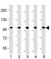 Western blot testing of LGR-5 antibody at 1:2000 dilution. Lane 1: mouse skeletal muscle; 2: rat skeletal muscle; 3: HeLa; 4: HepG2; 5: SH-SY5Y lysate; Predicted band size : 100 kDa.