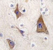 IHC analysis of FFPE human brain tissue stained with GPR49 antibody