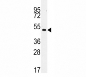 Western blot analysis of Desmin antibody and NCI-H460 lysate. Predicted molecular weight ~54kDa.