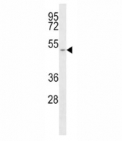 Western blot analysis of SLC16A1/ MCT1 antibody and T47D lysate.