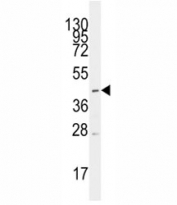 Western blot analysis of MCT1/ SLC16A1 antibody and CEM lysate.