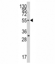 Western blot analysis of TRF1 antibody and Jurkat lysate. Predicted molecular weight: ~50kDa.