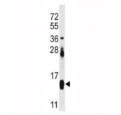 Western blot analysis of FABP4 antibody and mouse heart tissue lysate. Predicted molecular weight ~15 kDa.