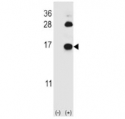 Western blot analysis of FABP4 antibody and 293 cell lysate (2 ug/lane) either nontransfected (Lane 1) or transiently transfected (2) with the FABP4 gene. Predicted molecular weight ~15 kDa.