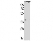 Western blot analysis of MBP antibody and NCI-H460 lysate. Multiple isoforms visualized from 20~37 kDa.