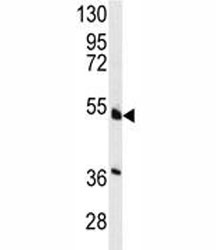 Western blot analysis of HNF4A antibody and NCI-H460 lysate.