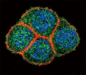 Confocal immunofluorescent analysis of HNF4A antibody with HeLa cells followed by Alexa Fluor 488-conjugated goat anti-rabbit lgG (green). Actin filaments have been labeled with Alexa Fluor 555 Phalloidin (red). DAPI was used as a nuclear counterstain (blue).