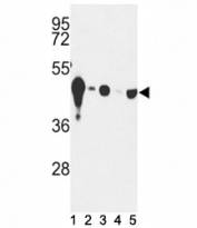 Western blot analysis of NSE antibody and (1) mouse cerebellum tissue and (2) Y79, (3) HepG2, (4) Jurkat and (5) CEM lysate. Predicted molecular weight: ~47 kDa.