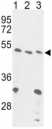 Western blot analysis of FOXP3 antibody and (1) 293, (2) Jurkat and (3) mouse liver lysate.