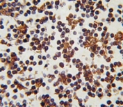 IHC analysis of FFPE human lymph tissue stained with FOXP3 antibody