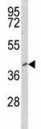 Western blot analysis of FOXP3 antibody and HepG2 lysate.