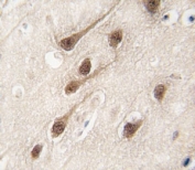 IHC analysis of FFPE human brain tissue stained with RUNX1 antibody