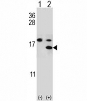 Western blot analysis of S100A11 antibody and 293 cell lysate either nontransfected (Lane 1) or transiently transfected (2) with the S100A11 gene.