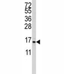Western blot analysis of S100A11 antibody and CEM lysate. Predicted molecular weight 12~15 kDa.~