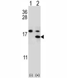 Western blot analysis of S100A11 antibody and 293 cell lysate either nontransfected (Lane 1) or transiently transfected (2) with the S100A
