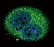 Confocal immunofluorescent analysis of IRF5 antibody with A549 cells followed by Alexa Fluor 488-conjugated goat anti-rabbit lgG (green). DAPI was used as a nuclear counterstain (blue).