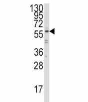 Western blot analysis of IRF5 antibody and Ramos lysate. Expected/observed molecular weight ~57 kDa.