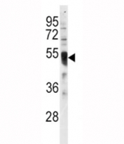 Western blot analysis of IRF8 antibody and HL-60 lysate. Predicted molecular weight ~48kDa.