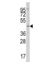 Western blot analysis of IRF8 antibody and Jurkat lysate. Predicted molecular weight ~48kDa.