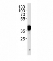 NPM1 antibody western blot analysis in HeLa lysate. Expected/observed molecular weight: ~38kDa.