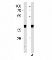 NPM1 antibody western blot analysis in 1) HeLa and 2) Jurkat lysate. Expected/observed molecular weight: ~38kDa.