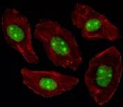 Fluorescent image of A549 cells stained with NPM1 antibody. Alexa Fluor 488 conjugated secondary was used (green). NPM1 immunoreactivity is localized to the nucleus and nucleolus significantly.