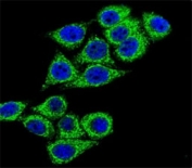 Confocal immunofluorescent analysis of CD38 antibody with HeLa cells followed by Alexa Fluor 488-conjugated goat anti-rabbit lgG (green). DAPI was used as a nuclear counterstain (blue).