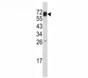 Western blot analysis of CD105 antibody and mouse heart tissue lysate. Observed molecular weight: 70/90 kDa (monomer, unmodified/glycosylated); 140-180 kDa (dimer, unmodified/glycosylated).