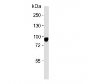 Western blot analysis of CD105 antibody and human HeLa cell lysate. Observed molecular weight: 70/90 kDa (monomer, unmodified/glycosylated); 140-180 kDa (dimer, unmodified/glycosylated).