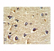 IHC analysis of FFPE human brain tissue stained with CD166 antibody