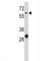 Western blot analysis of CD166 antibody and NCI-H460 lysate. Predicted molecular weight ~65 kDa (unmodified), 100-105 kDa (glycosylated).