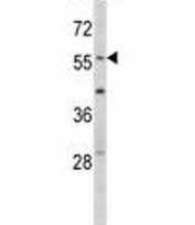 Western blot analysis of EGR1 antibody and mouse NIH3T3 lysate. Predicted molecular weight ~58 kDa.