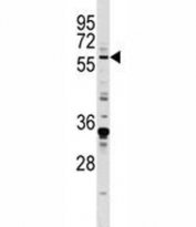 EGR1 antibody western blot analysis in MDA-MB231 lysate. Predicted molecular weight ~58 kDa.