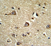 IHC analysis of FFPE human brain tissue stained with PHGDH antibody