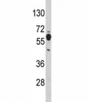 Western blot analysis of PHGDH antibody and mouse brain tissue lysate. Predicted molecular weight ~56 kDa.