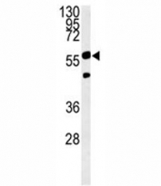 PHGDH antibody western blot analysis in Ramos lysate. Predicted molecular weight ~56 kDa.