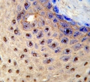 IHC analysis of FFPE human skin stained with PAX3 antibody