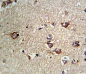 IHC analysis of FFPE human brain tissue stained with CD71 antibody