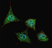 Fluorescent confocal image of HeLa cells stained with phospho-Bad antibody at 1:200. Note the highly specific localization of phos/nonphos-Bad, predominantly to the cytoplasm.