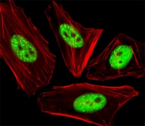Fluorescent image of HeLa cells stained with phospho-CDC25A antibody at 1:25 dilution. An Alexa Fluor 488-conjugated goat anti-rabbit lgG was used as the secondary Ab (green). Cytoplasmic actin was counterstained with Alexa Fluor 555 conjugated with Phalloidin (red).