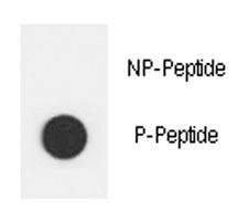 Dot blot analysis of phospho-ERBB2 antibody. 50ng of phos-peptide or