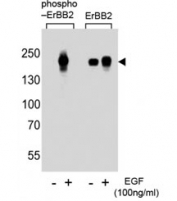 Western blot analysis of extracts from A431 cells, untreated or treated with EGF at 100ng/ml, using phospho-ErBB2 antibody (left) or nonphos-ErBB2 antibody (right).