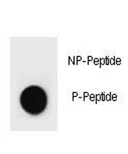 Dot blot analysis of p-ErbB2-antibody. 50ng of phos-peptide or nonphos-peptide per dot we