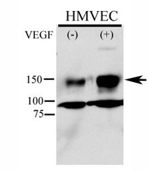 Phospho-KDR antibody used in western blot to detect phosphorylated KDR/FLK1 in HMVEC lysate. Endothelial cells were stimulated with 50ug/ml VEGF for 5min and Ab used at 1:500. Predicted molecular weight ~ 152 kDa.~