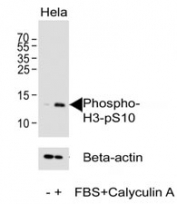 Western blot analysis of lysate from HeLa cell line using phospho-Histone H3 antibody at 1:1000.