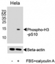 Western blot analysis of lysate from HeLa cell line, untreated or treated with FBS + Calyculin A (100ng/ml), using phospho-Histone H3 antibody