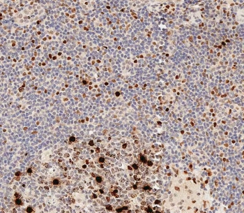 IHC staining of FFPE human tonsil with phospho-Histone H3 antibody. HIER: boil tissue sections in pH 9 10mM Tris with 1mM EDTA for 20 min and allow to cool before testing.